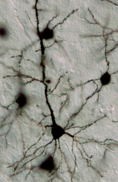 Golgi Technique