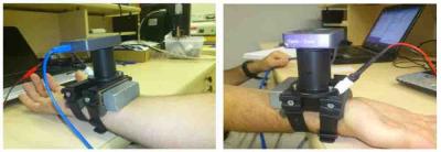 Wearable Glucose Monitor