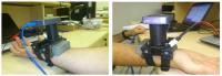 Wearable Glucose Monitor