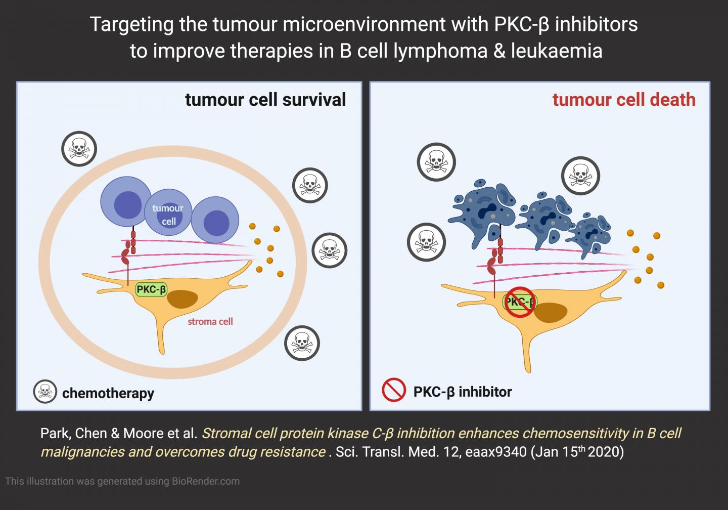Strangling the Stroma Overcomes Treatment Resistance in B Cell Cancers (1 of 3)