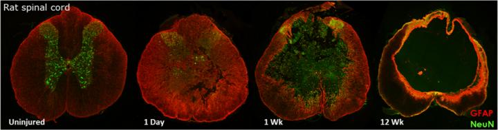 Progression of Injury in Rat Spinal Cord