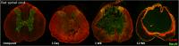 Progression of Injury in Rat Spinal Cord