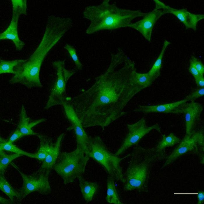 Fluorescent microscopy image of mesenchymal stromal cells