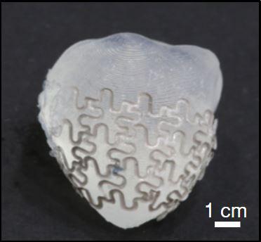 Mesh Implant Gives Failing Heart a Boost (2 of 5)