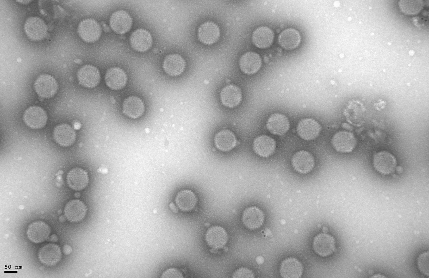 Virus-Based Therapy Targets a Pediatric Eye Cancer (3 of 3)