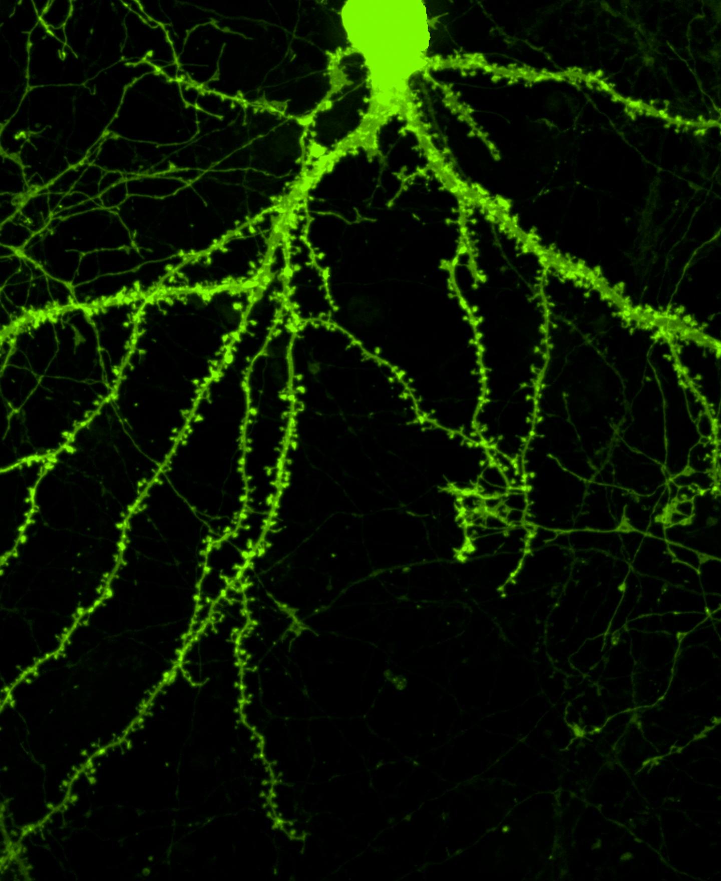 Dendritic Spines Sprout on a Treated Neuron