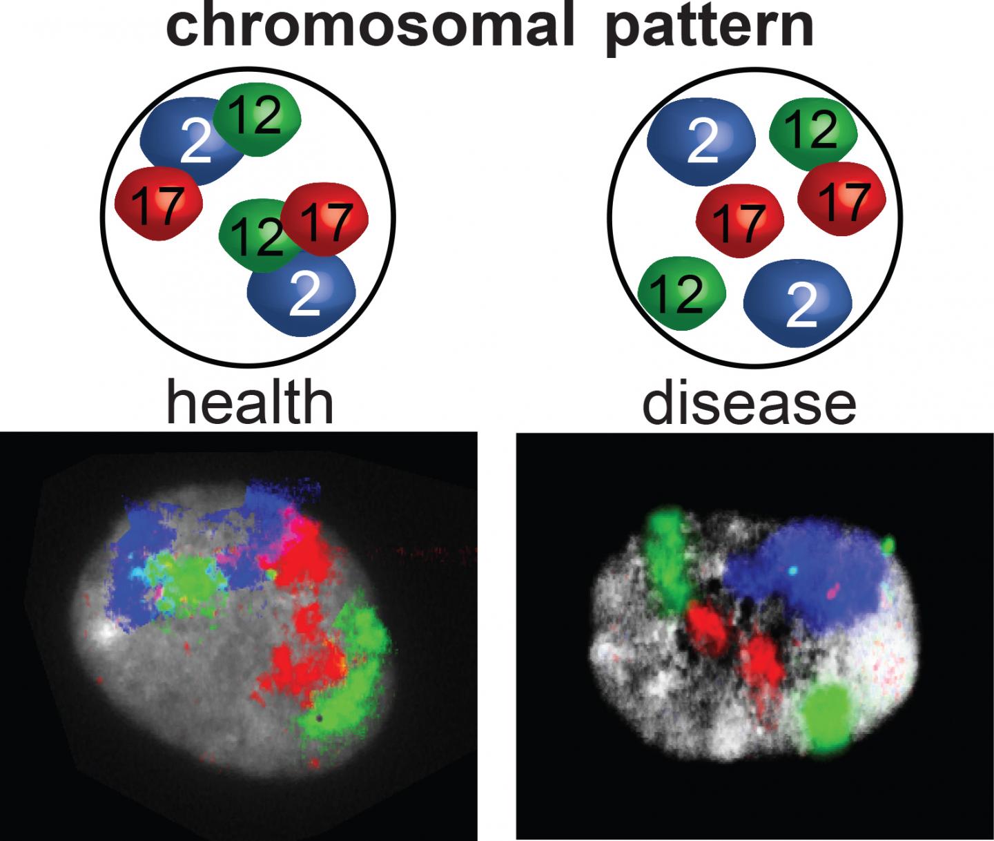 Chromoson Pattern