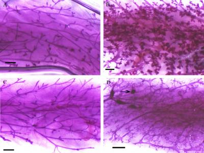 A Striking Degree of Abnormal Cell Growth