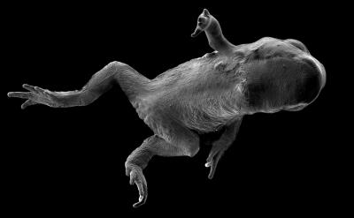 Secrets of a Deadly Frog Disease (1 of 2)