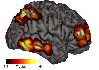 Brain Consciousness