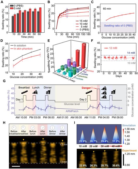 PolyU develops wearable microneedle patch to empower conventional ultrasound for continuous glucose monitoring