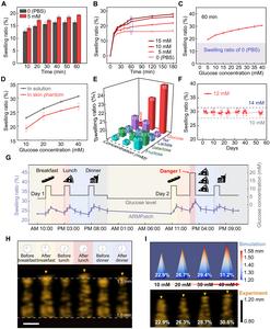 PolyU develops wearable microneedle patch to empower conventional ultrasound for continuous glucose monitoring