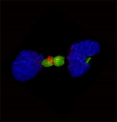 Telltale Fusion Gene in Brain Cancer (1 of 4)