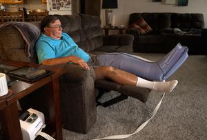 Leg Pump for Lymphedema