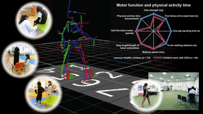 Motor Function and Physical Activity Time of Children with Congenital Diaphragmatic Hernia