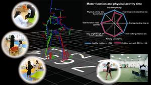 Motor Function and Physical Activity Time of Children with Congenital Diaphragmatic Hernia