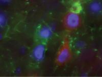 ALS treatment delays disease and extends life in rats | EurekAlert!