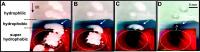Sequential Images of Ice Removal