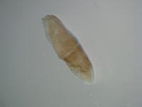 <I>Xenoturbella</I>