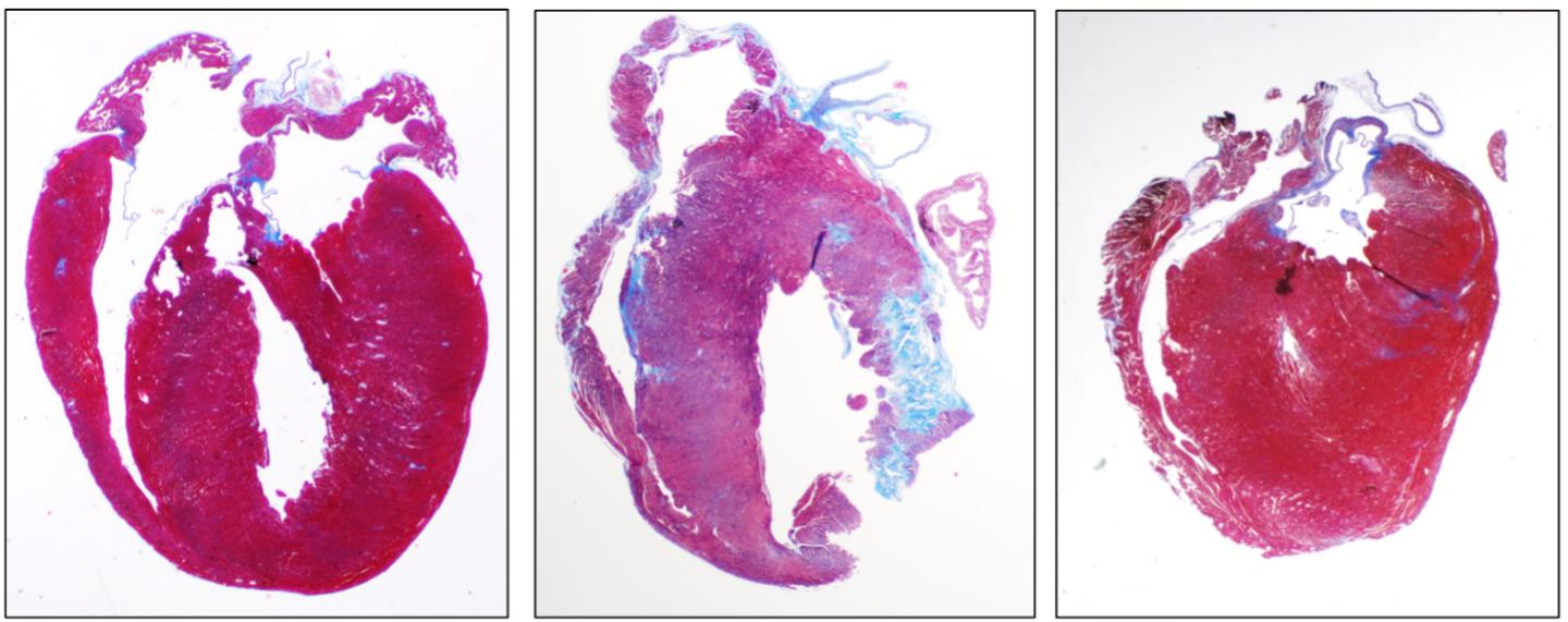 Healthy Mouse Heart
