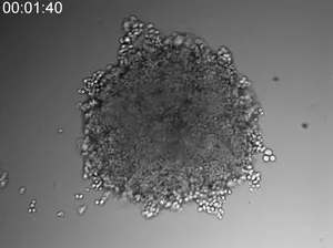 Phase contrast images of a HeLa cell spheroid cleared with SeeDB-Live