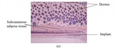 Nanodiamond-Silk Material Implanted in Tissue