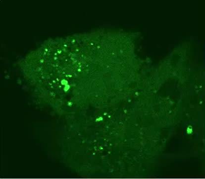 FAU Researchers Find New Mechanism Cells Use to Eat Other Before They Become Toxic
