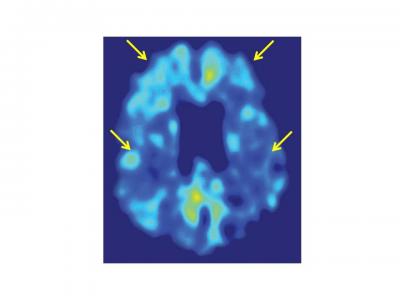 Brain Scan
