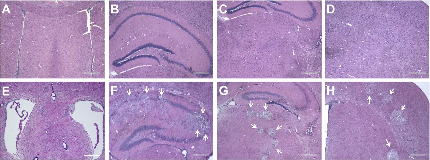 Zika's Negative Effects, As Seen in Human Newborns, Persist in Adults, Mouse Study Shows (2 of 4)