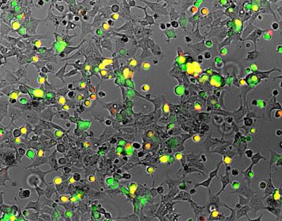 KSHV Infected Cells