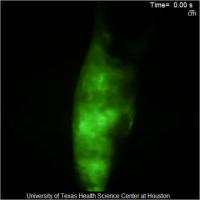 Lower Leg of a Subject with Lymphedema