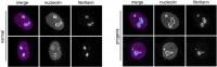 Nucleoli Enlarged in Aging Cells
