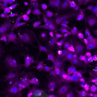 <em>Salmonella typhimurium</em>-Infected Cells