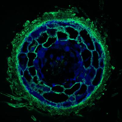 Crosscut of Fungal Tissues and <i>Pinus sylvestris</i> Plant Root Cells