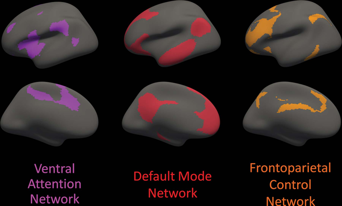 White Matter Integrity Disrupted in People with Alzheimer’s Gene Mutation