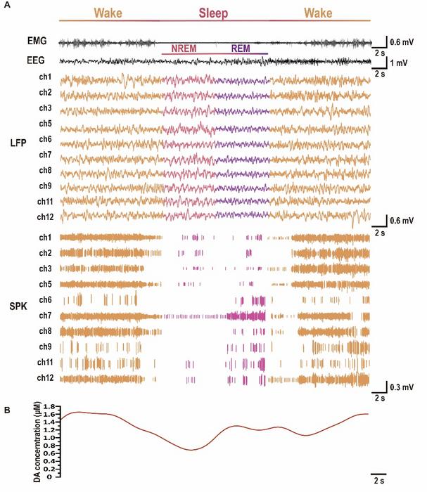 Fig. 3. In vivo neural activity and corresponding DA fluctuations across wake, non-rapid eye movement (NREM), and REM measured with the MT MEA.