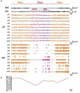Fig. 3. In vivo neural activity and corresponding DA fluctuations across wake, non-rapid eye movement (NREM), and REM measured with the MT MEA.