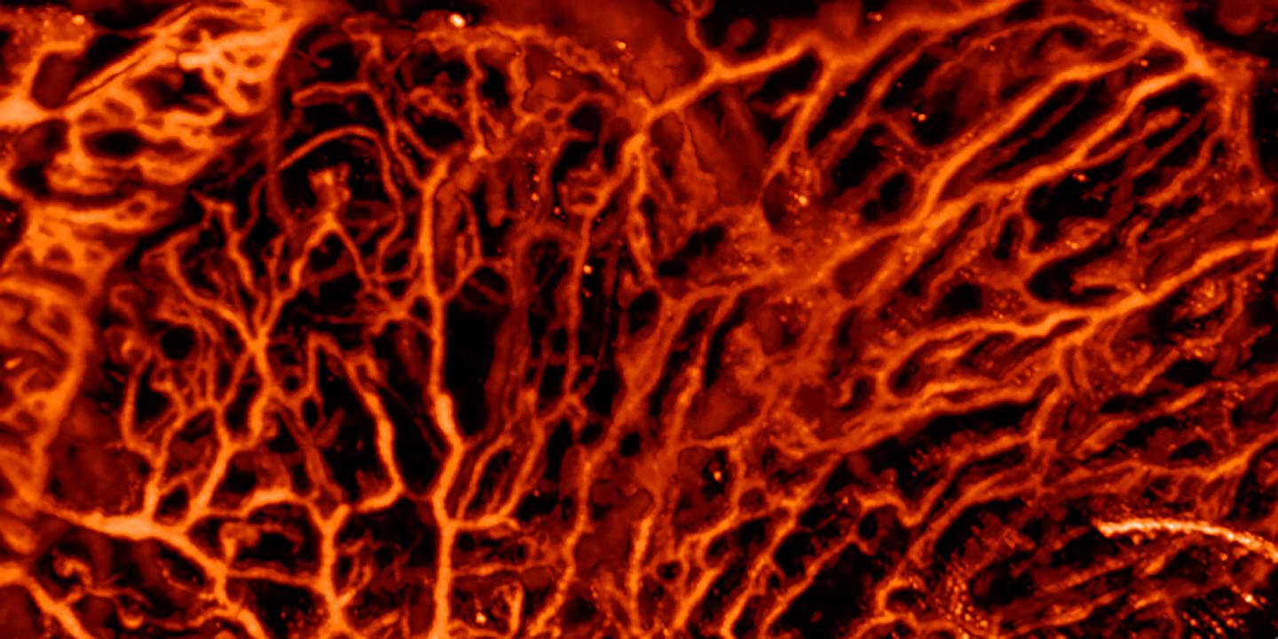 Blood Vessels