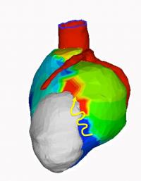 Noninvasive Mapping