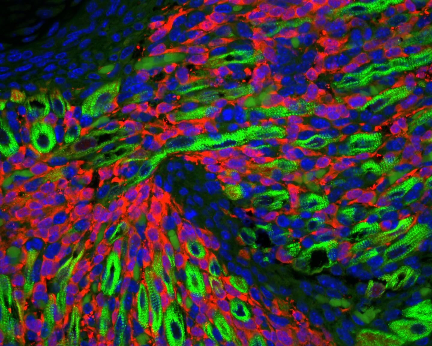 Finding Out Where They Begin to Possibly Pinpoint Targets for New Drugs