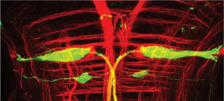 Zebrafish Hindbrain