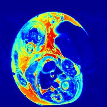 UGA Zika Research