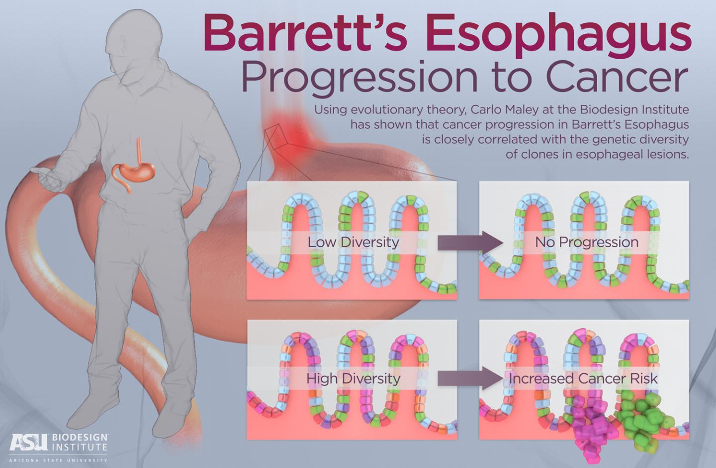 Progression to Cancer