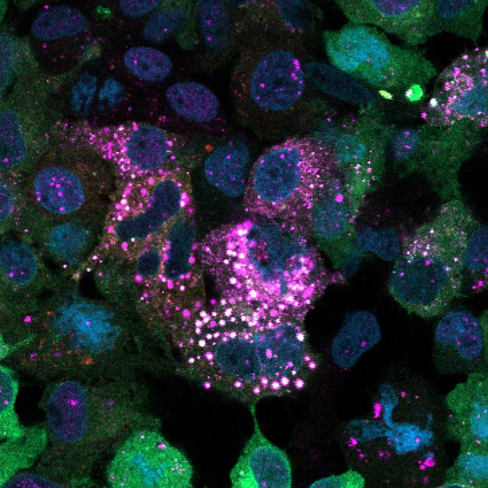 Glycogen_Microscopy