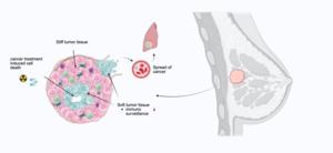 Cancer cells in a soft microenvironment