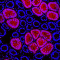 Red2Onco confocal microscopy 2