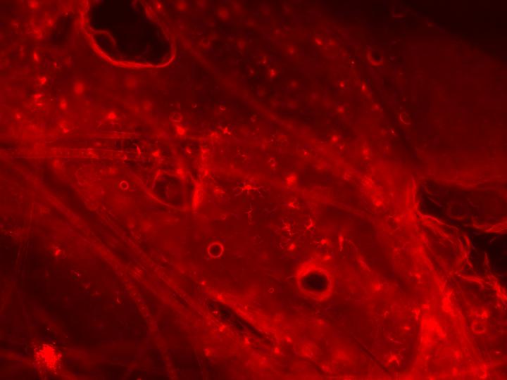 Langerhans cells are up to the job, they just need a chance