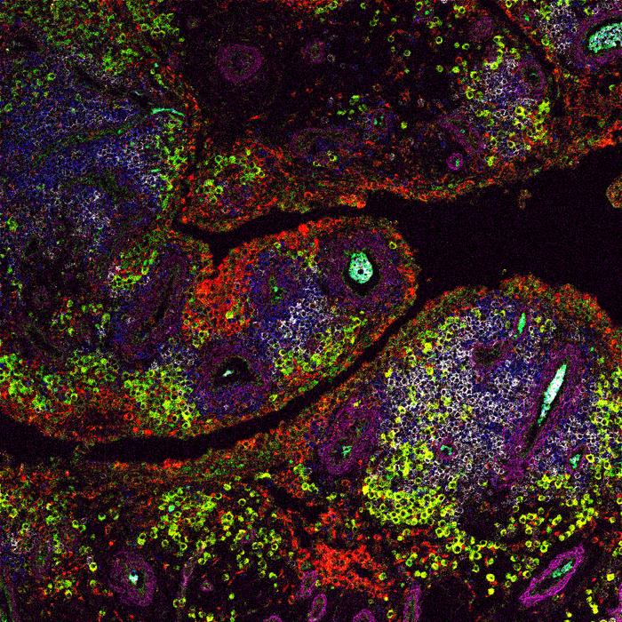 Imaging mass cytometry of an inflamed synovial membrane in osteoarthritis