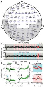 图4 基于脉冲序列的oddball范式中人的EEG记录结果