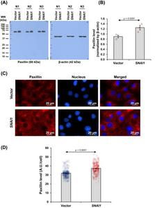 SNAI1 overexpression induced focal adhesion organization in renal tubular cells.